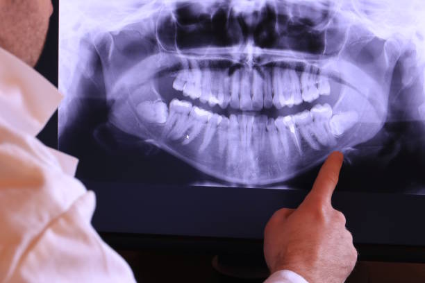 Best Broken or Chipped Tooth Repair in Neah Bay, WA